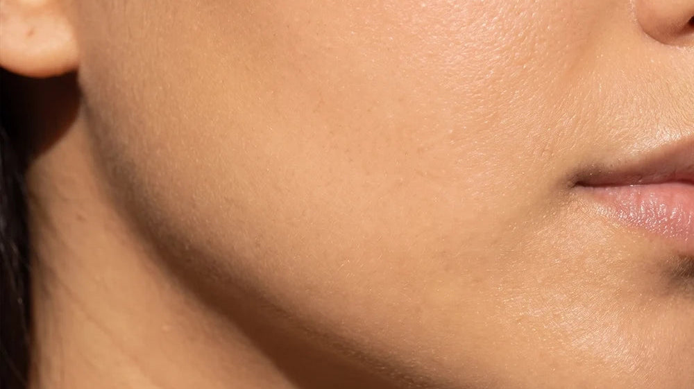 Skin Barrier Support