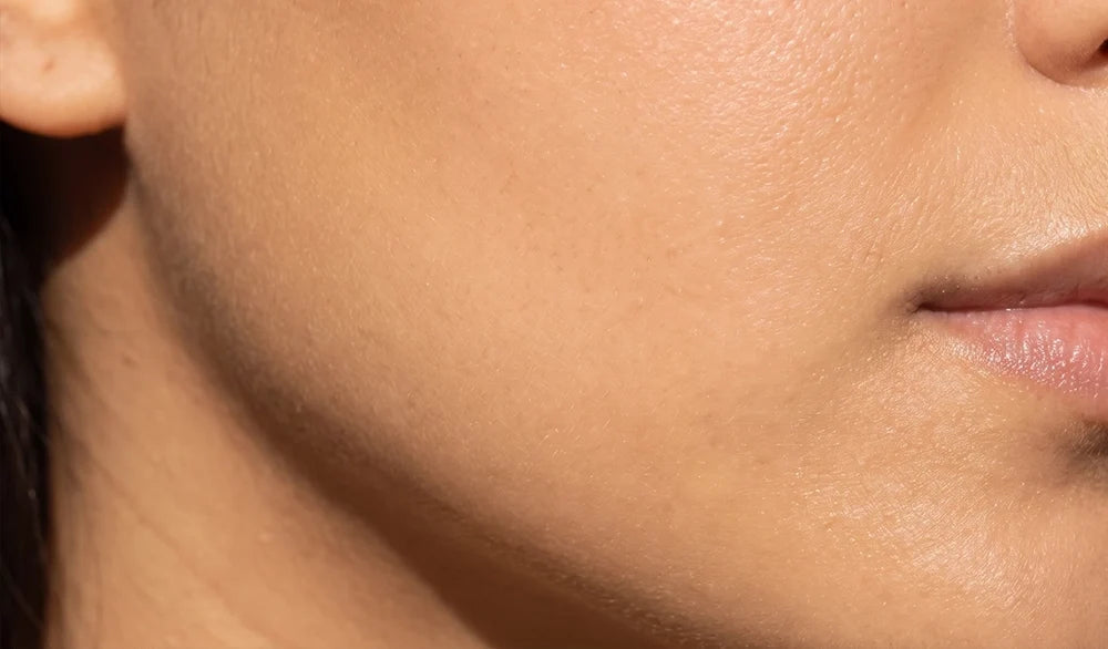 Skin Barrier Support